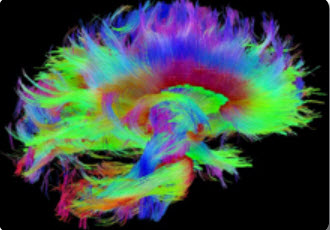 vue de profil de couleur arc-en-ciel du cerveau